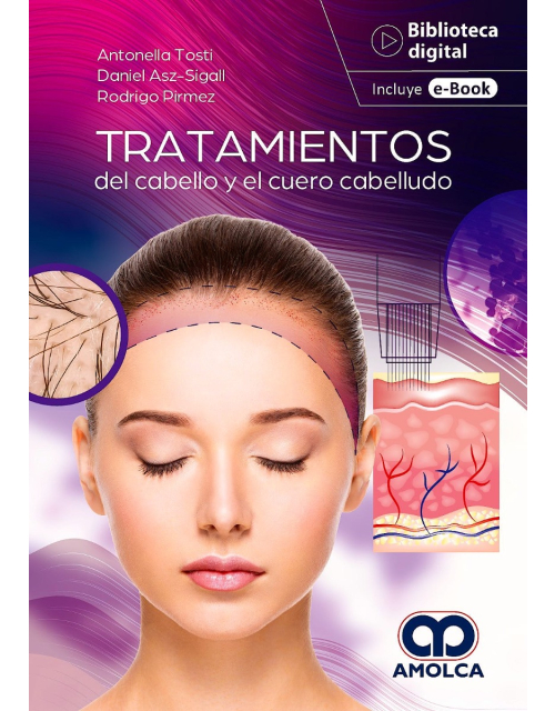 Tratamientos del Cabello y el Cuero Cabelludo