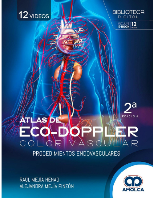 Atlas de Eco-Doppler Color Vascular. Procedimientos Endovasculares
