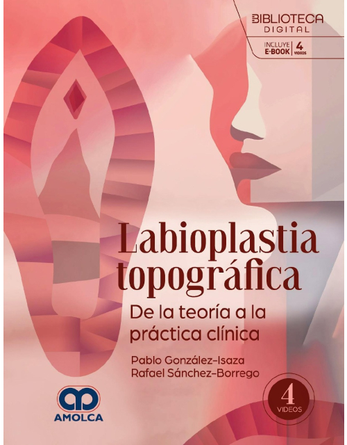 Labioplastia Topográfica. De la Teoría a la Práctica Clínica