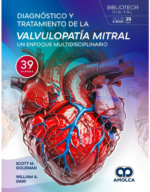 Diagnóstico y Tratamiento de la Valvulopatía Mitral