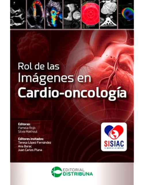Rol de las imágenes en cardio-oncología