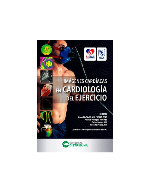 Imágenes cardiacas en cardiología del ejercicio