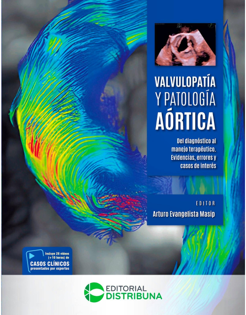 Valvulopatía y patología aórtica