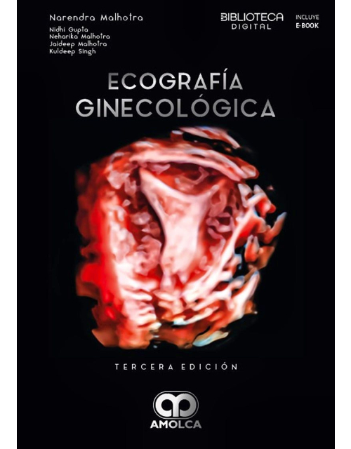 Ecografía ginecológica