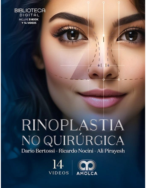Rinoplastia No Quirúrgica