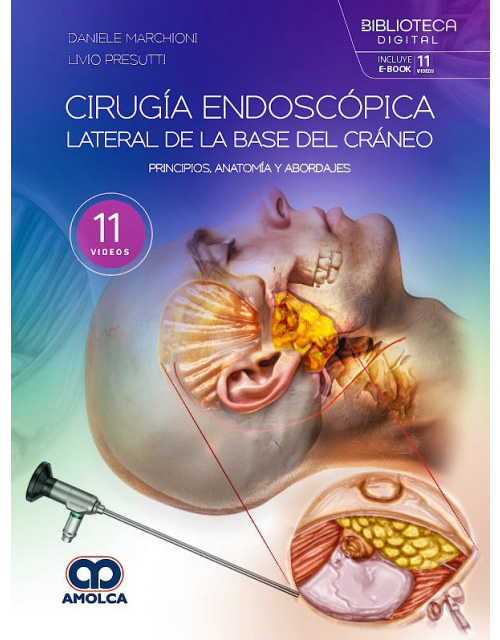 Cirugía Endoscópica Lateral de la Base del Cráneo