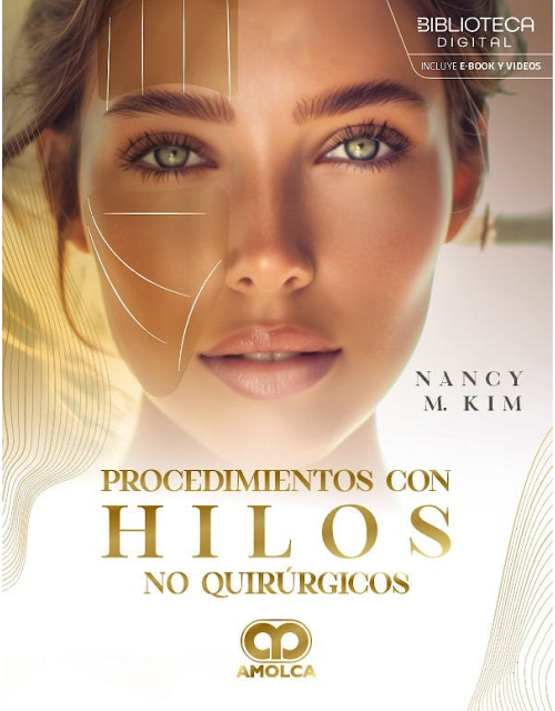 Procedimientos con Hilos No Quirúrgicos
