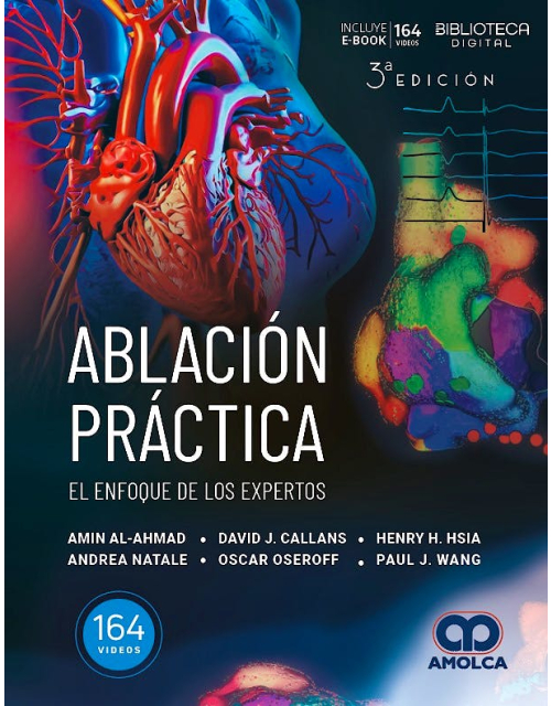 Ablación Práctica. El Enfoque de los Expertos