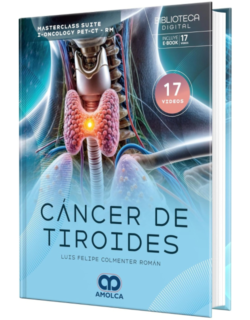 Cáncer de Tiroides. Masterclass Suite I-Oncology PET-CT-RM