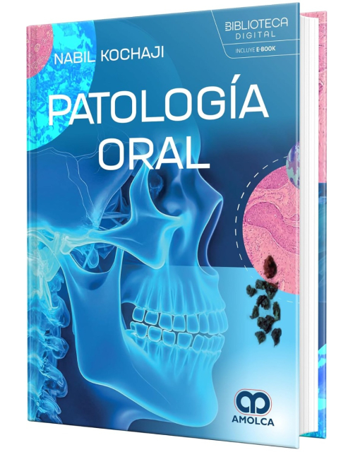 Patología Oral 1ª