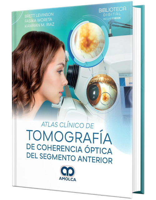 Atlas Clínico de Tomografía de Coherencia Óptica del Segmento Anterior