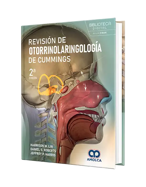 Revisión de Otorrinolaringología de CUMMINGS