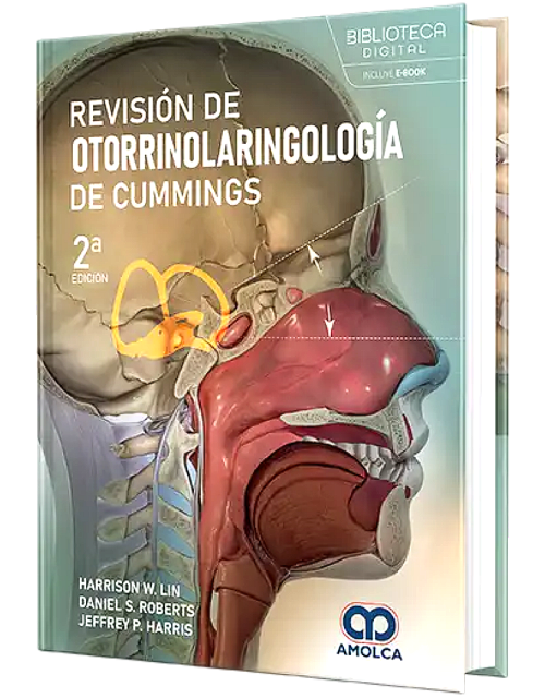 Revisión de Otorrinolaringología de CUMMINGS