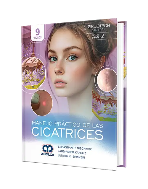 Manejo Práctico de las Cicatrices