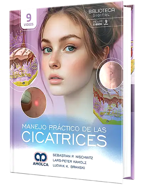 Manejo Práctico de las Cicatrices