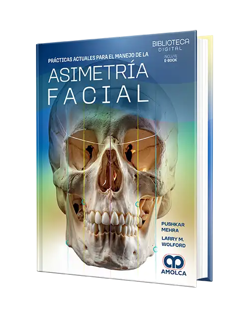 Manejo de la Asimetría Facial. Principios y Prácticas Actuales