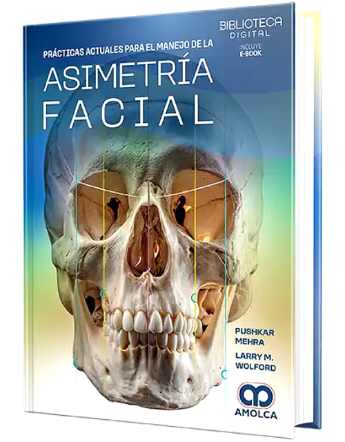 Manejo de la Asimetría Facial. Principios y Prácticas Actuales