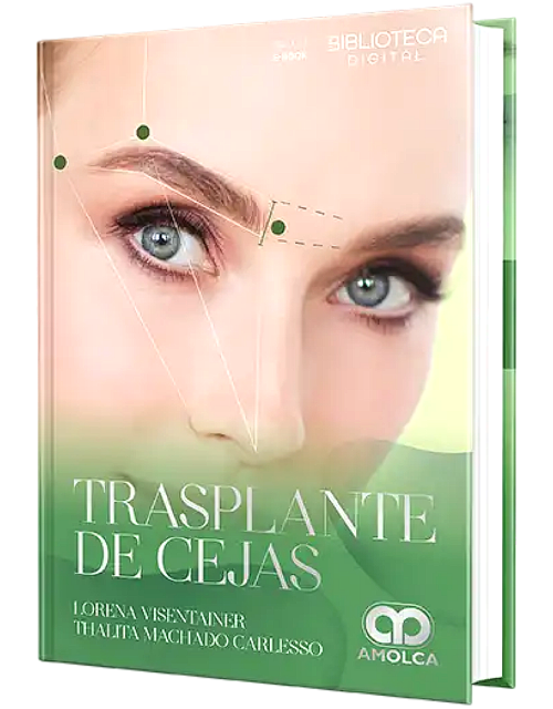 Trasplante de Cejas