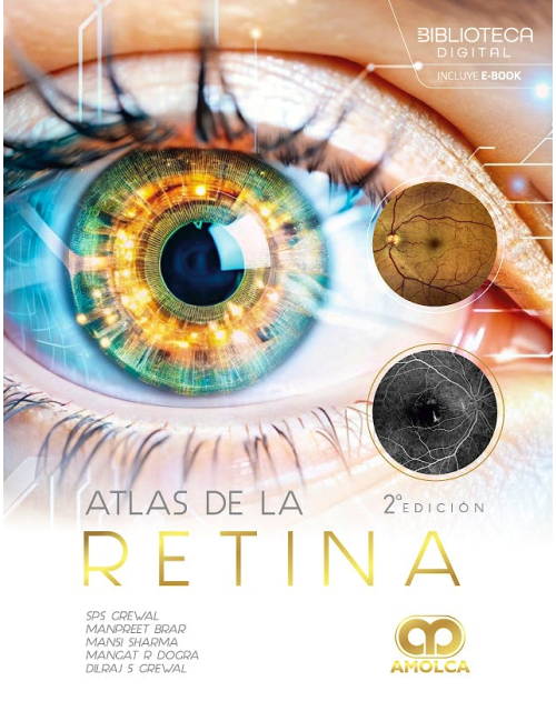 Atlas de la Retina
