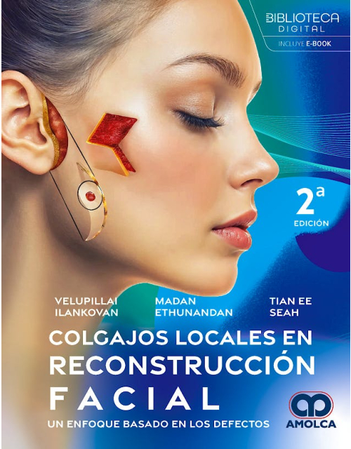 Colgajos Locales en Reconstrucción Facial. Un Enfoque Basado en los Defectos