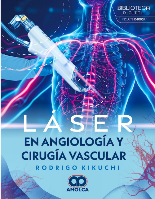 Láser en Angiología y Cirugía Vascular