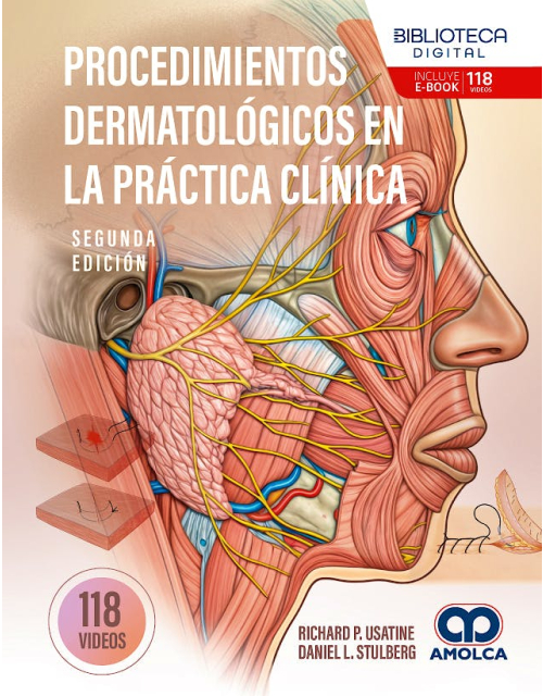 Procedimientos Dermatológicos en la Práctica Clínica