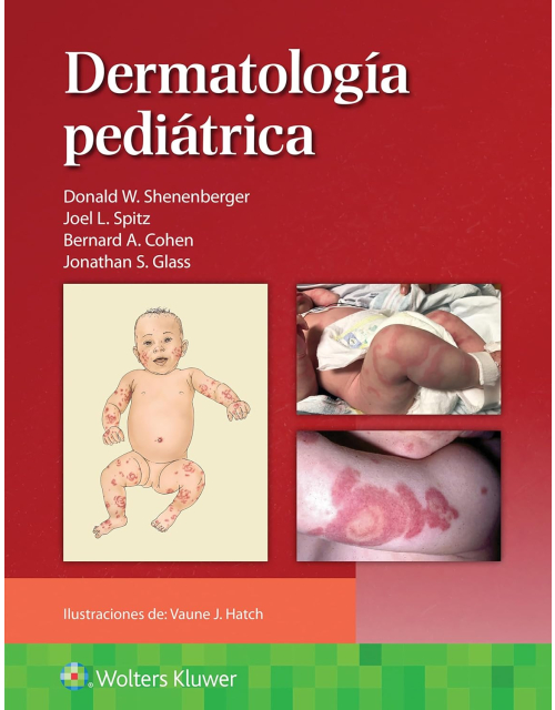 Dermatología pediátrica 1ª