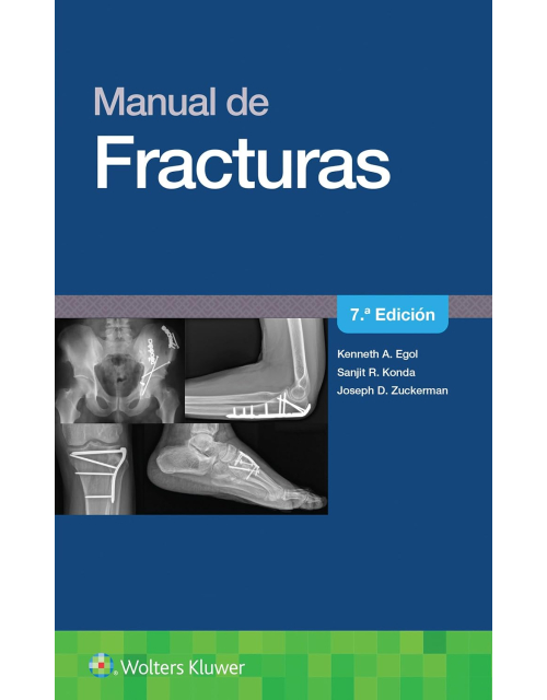 Manual de Fracturas