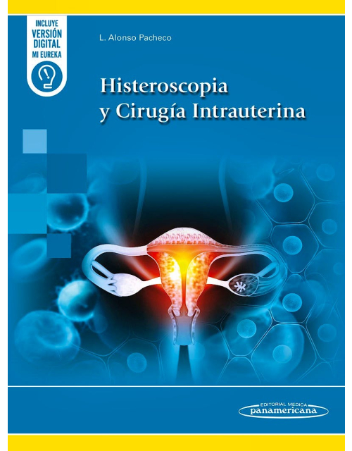 Histeroscopia y Cirugía Intrauterina.
