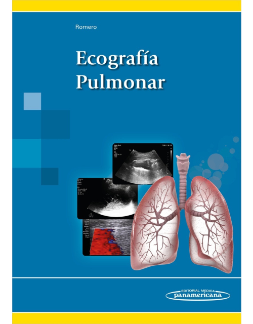 Ecografía Pulmonar