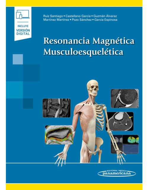 Resonancia Magnética Musculoesquelética