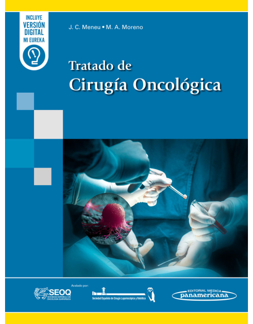 Tratado de Cirugía Oncológica