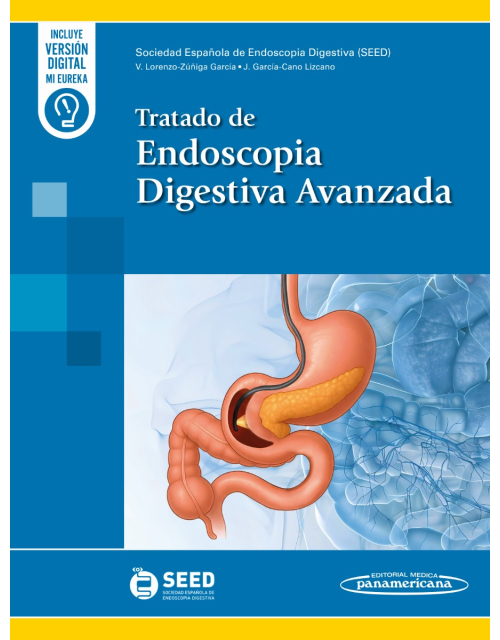 Tratado de Endoscopia Digestiva Avanzada