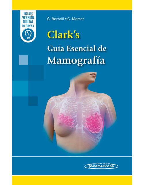Clark's Guía Esencial de Mamografía