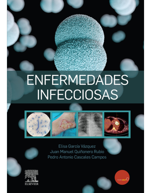 Enfermedades Infecciosas