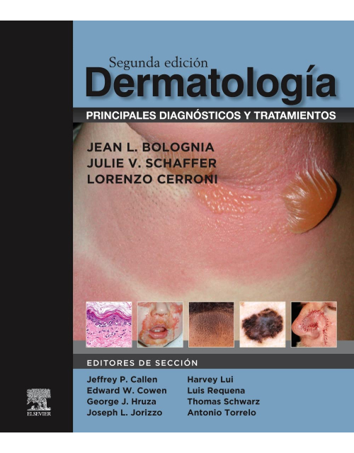 Dermatología. Principales Diagnósticos y Tratamientos
