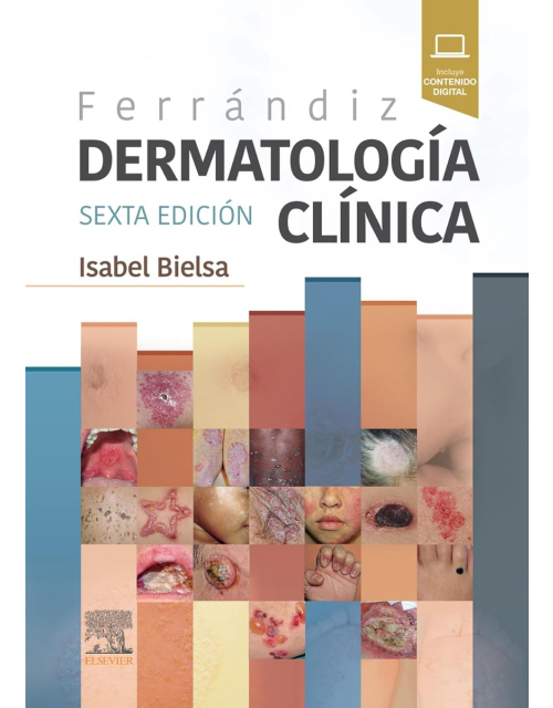 Ferrándiz. Dermatología clínica