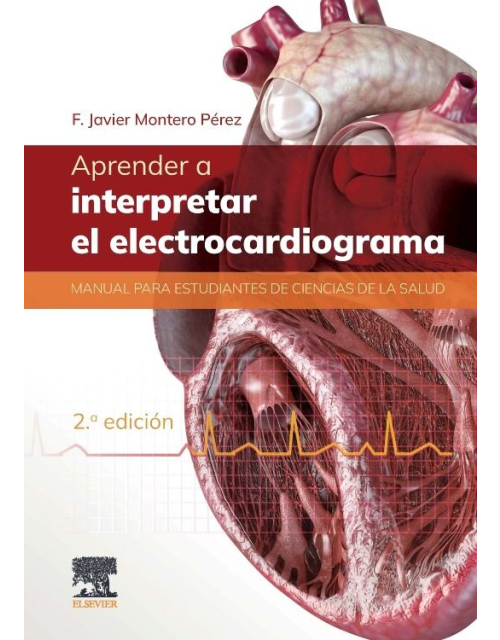 Aprender a Interpretar el Electrocardiograma.