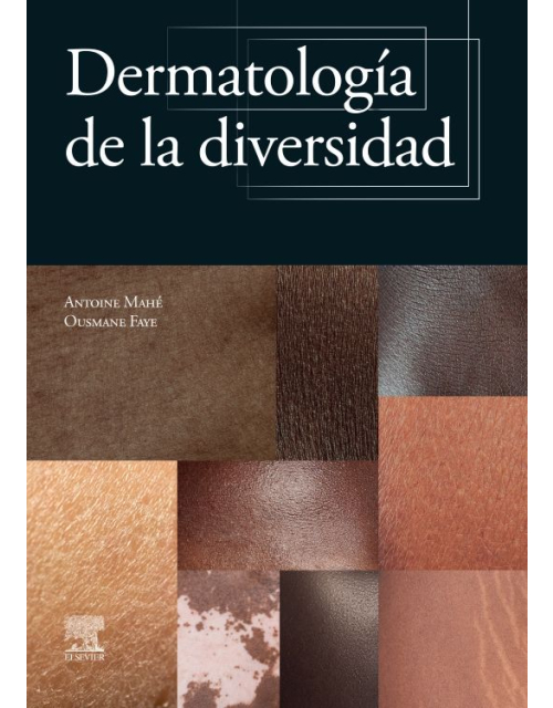 Dermatología de la diversidad