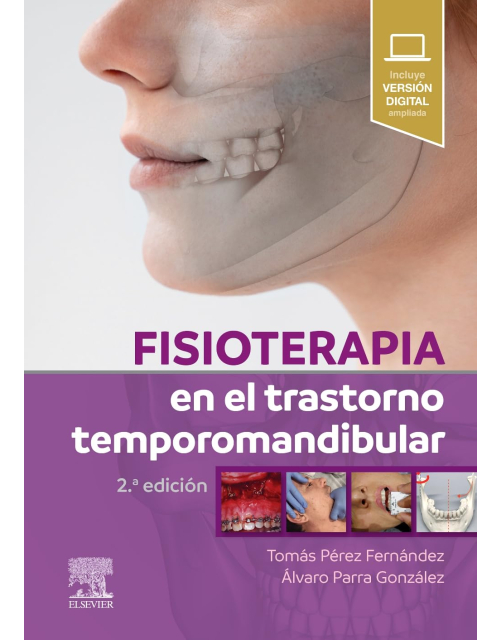 Fisioterapia en el trastorno temporomandibular