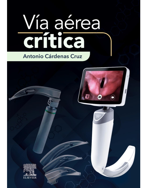 Vía aérea crítica