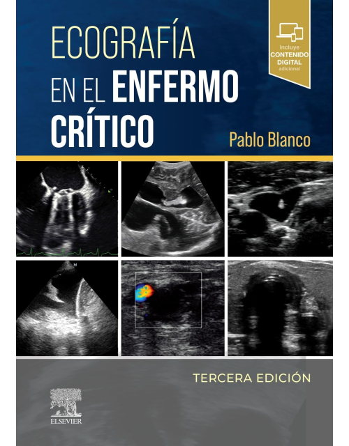 Ecografía en el enfermo crítico