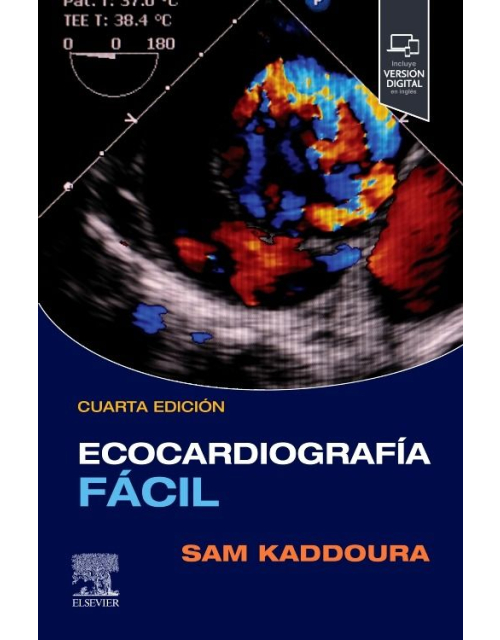 Ecocardiografía fácil