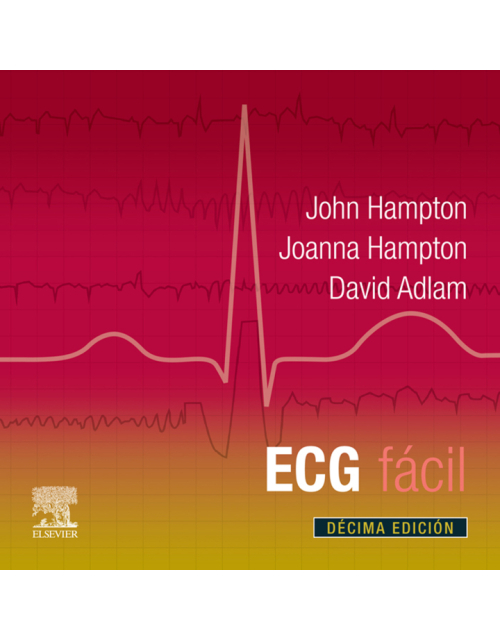ECG Fácil