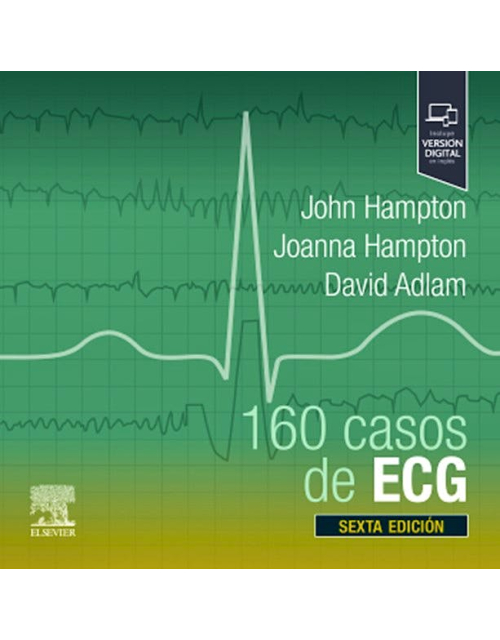160 Casos de ECG