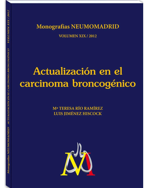 Actualizacion En El Carcinoma