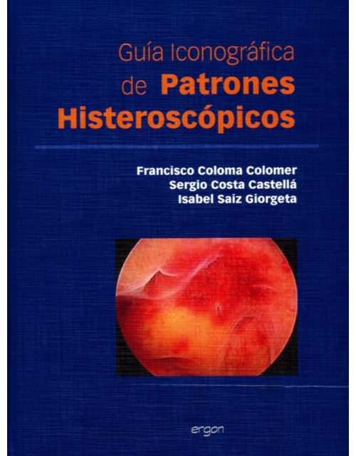 Guia Iconografica De Patrones Histeroscopicos