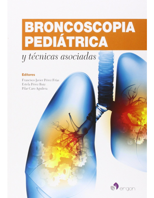 Broncoscopia Pediatrica Y Tecnicas Asociadas