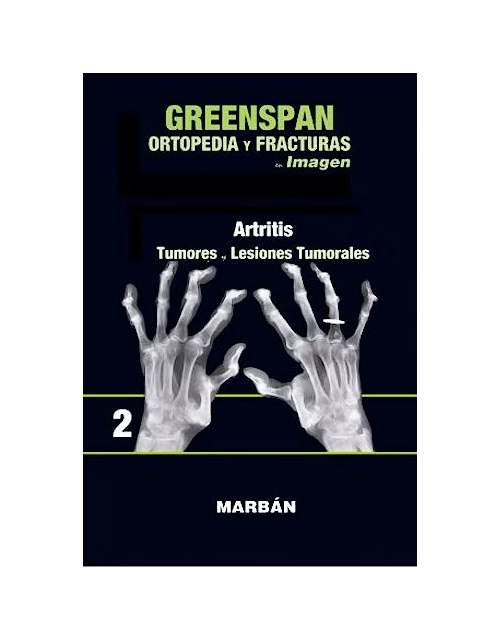 Ortopedia y Fracturas en Imagen, Vol. 2: Artritis. Tumores y Lesiones Tumorales