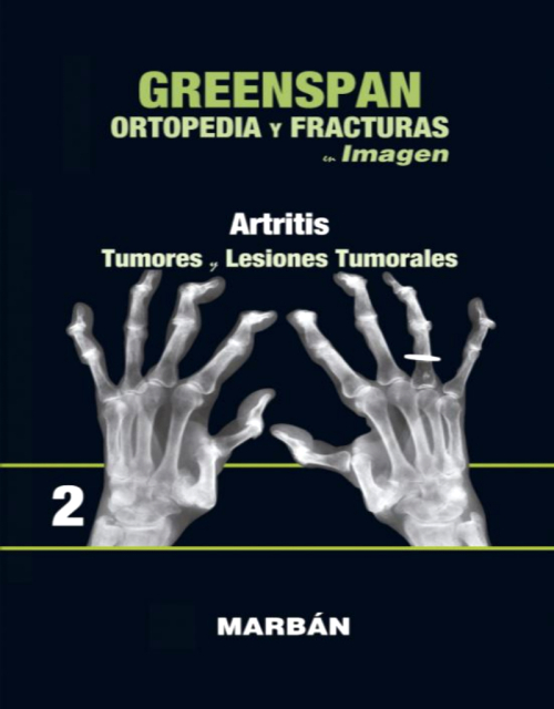 Ortopedia y Fracturas en Imagen, Vol. 2: Artritis. Tumores y Lesiones Tumorales